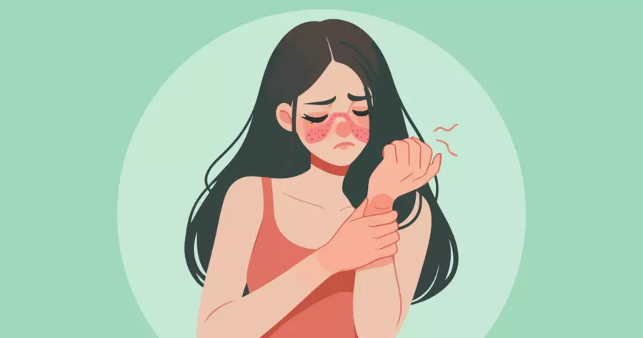 Understanding Lupus Flares: Triggers, Symptoms, and Management