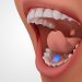 Under the Tongue: The Rise of Sublingual OTC Medications for Rapid Relief