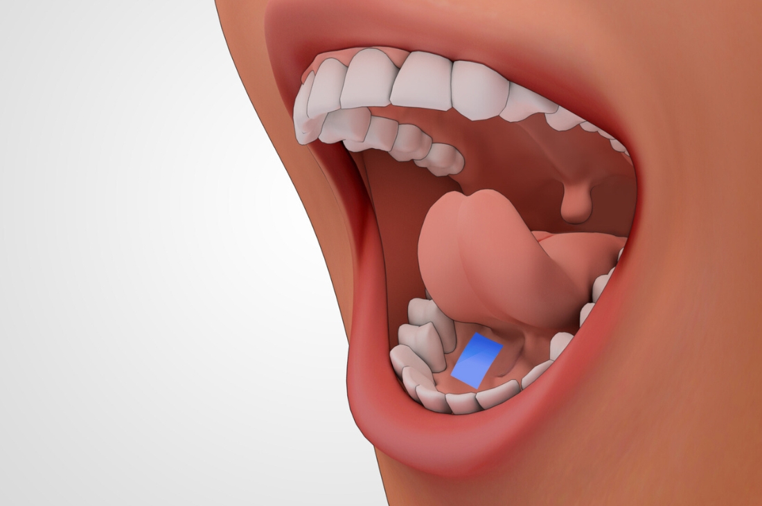 Under the Tongue: The Rise of Sublingual OTC Medications for Rapid Relief