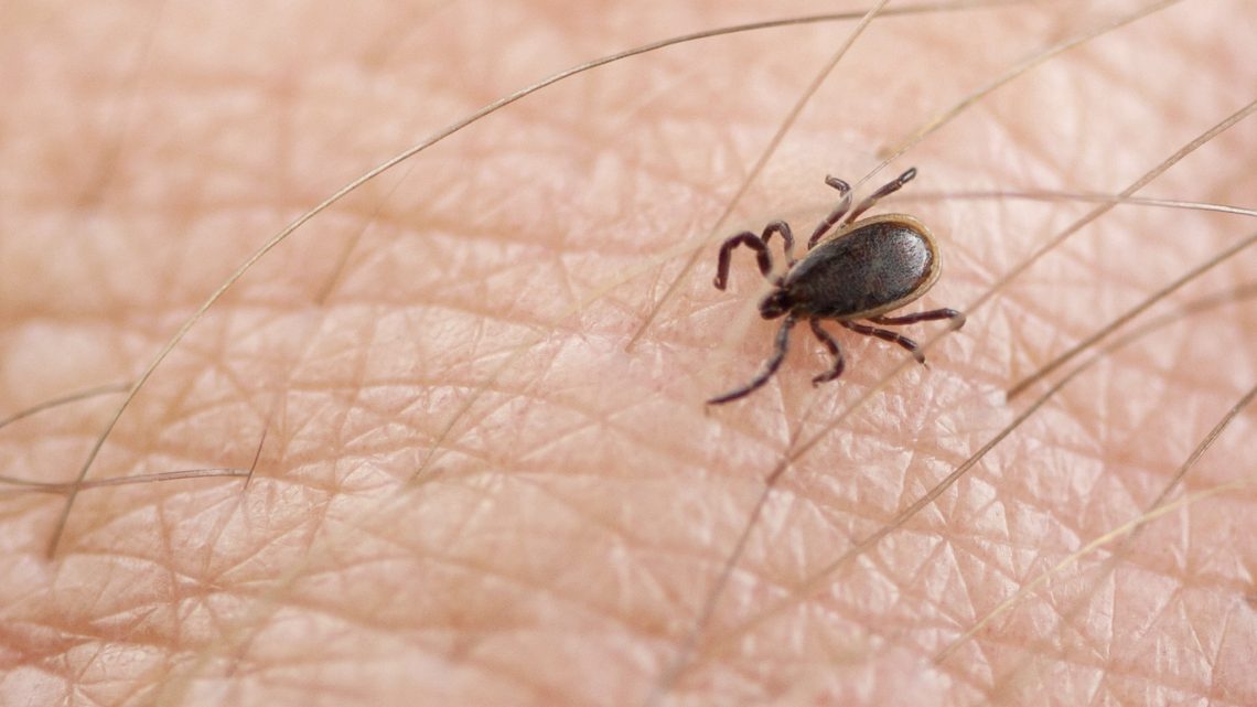 Chronic Lyme Debate: Understanding the Controversy