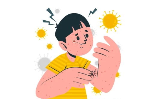 Measles Symptoms: The Rash, Fever, Cough, and Koplik's Spots