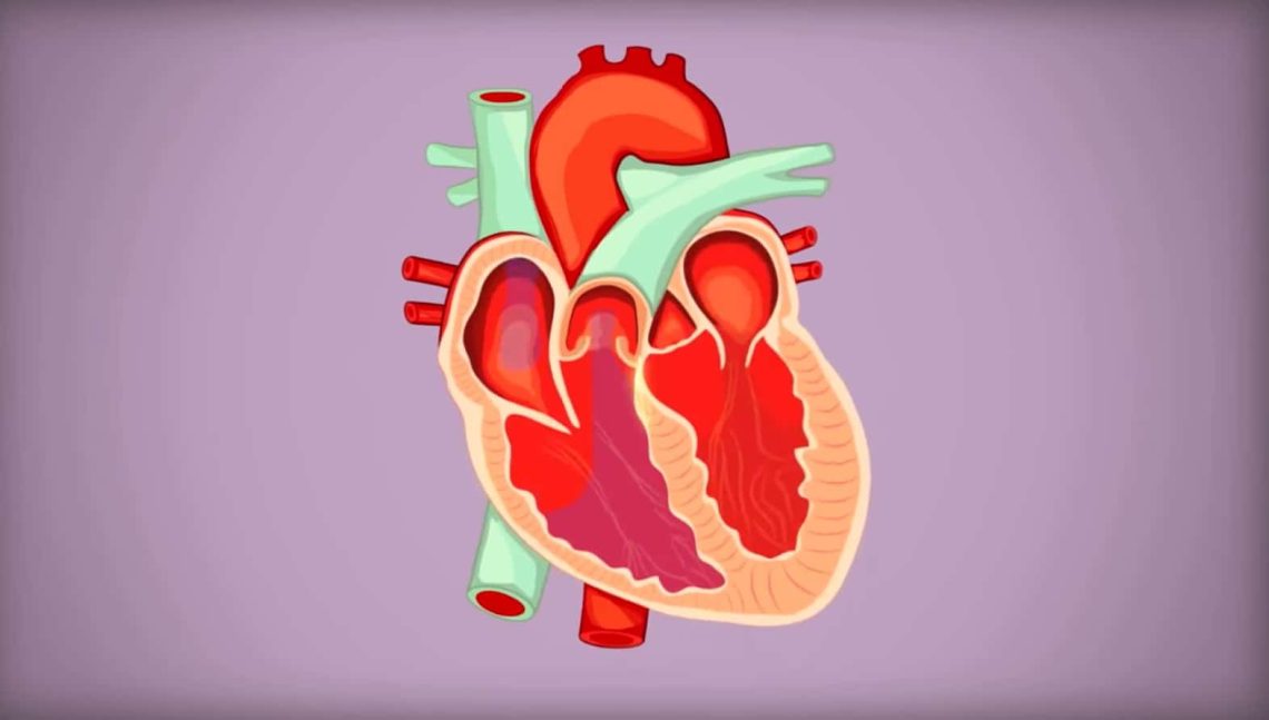 Arrhythmias Explained: From AFib to PVCs - Symptoms & Treatments