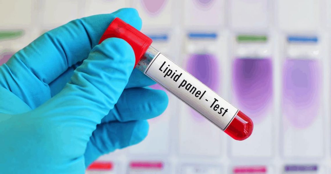HDL vs. LDL vs. Triglycerides: Breaking Down Your Lipid Panel