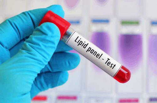 HDL vs. LDL vs. Triglycerides: Breaking Down Your Lipid Panel