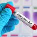 HDL vs. LDL vs. Triglycerides: Breaking Down Your Lipid Panel