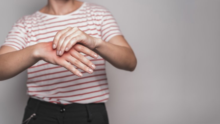 Lupus Misdiagnosis: Why It Happens and Getting the Right Answer