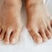 Early Signs of Arthritis: When to Seek Evaluation