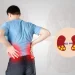 Kidney Stone Pain: What to Expect & How to Manage It