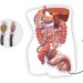 Non-Surgical Stone Treatments: ESWL & Ureteroscopy Explained