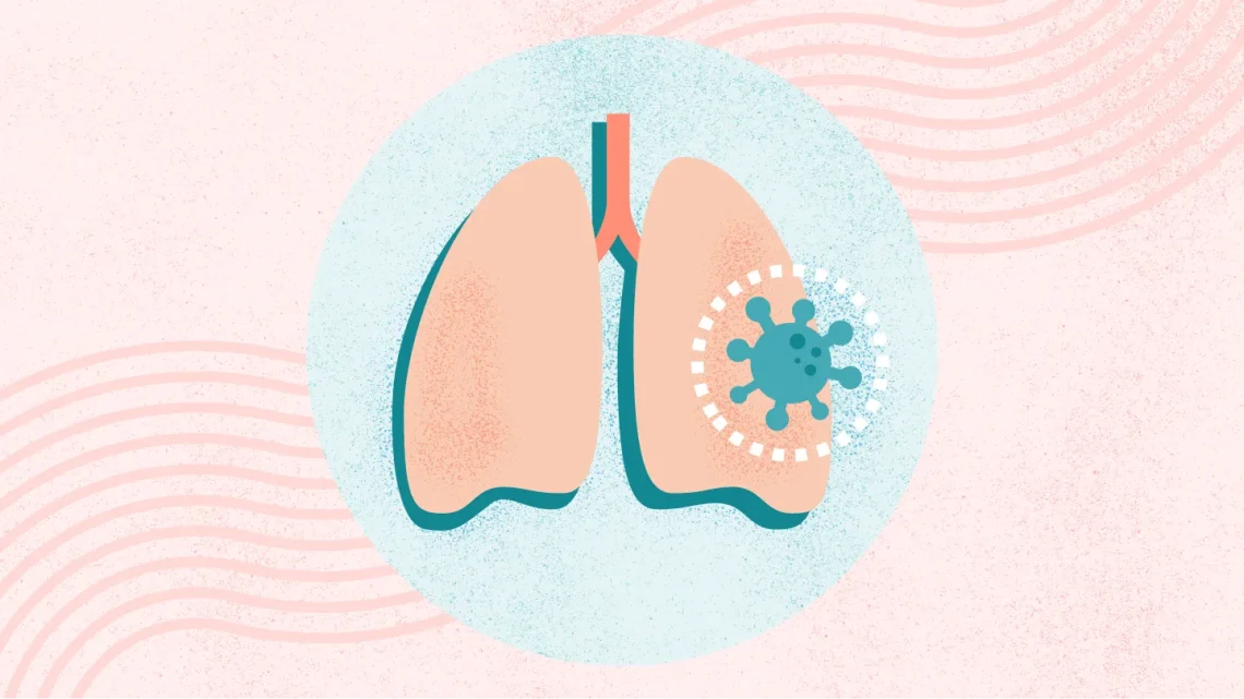 Bronchitis vs. Pneumonia: How to Tell Them Apart