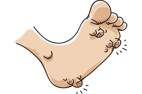 Genital Warts: Treatment Options and What to Expect