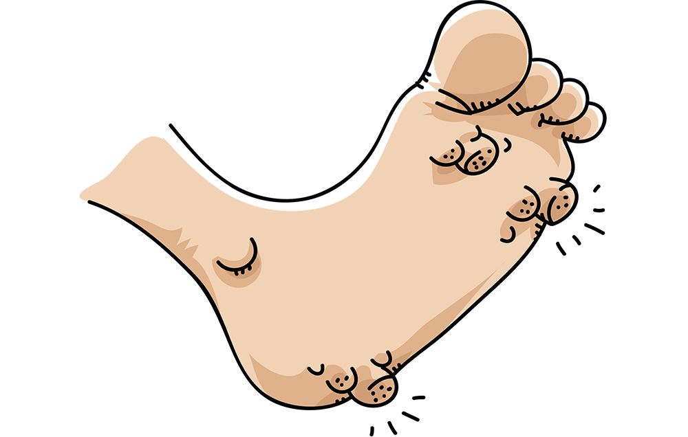 Genital Warts: Treatment Options and What to Expect