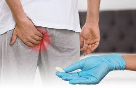 When to See a Doctor for Hemorrhoids: Signs You Need Professional Help