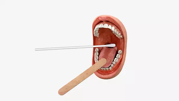 Rapid Strep Test vs. Throat Culture: Understanding the Diagnosis
