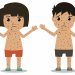 Why Measles is So Contagious (R0 Value Explained)