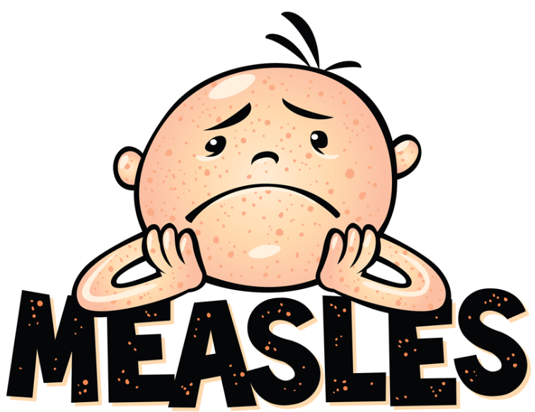 Measles Complications: Pneumonia, Encephalitis, SSPE