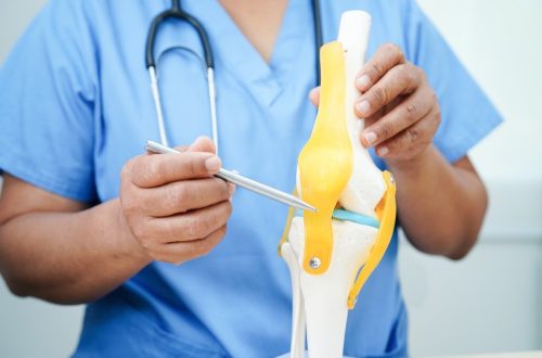 Osteoarthritis vs. Rheumatoid Arthritis: Key Differences Explained