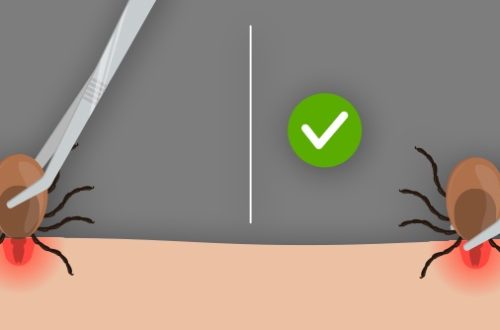 How to Properly Remove a Tick