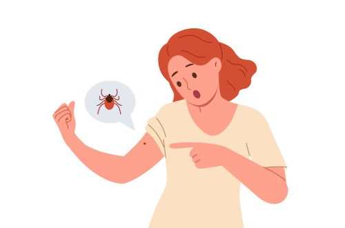 Lyme Disease Testing: Understanding Limitations and Stages