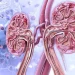 Lupus and Kidney Disease (Lupus Nephritis): Monitoring & Treatment