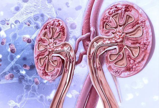 Lupus and Kidney Disease (Lupus Nephritis): Monitoring & Treatment