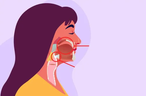 HPV and Cancer: The Link Between Virus and Cervical/Throat/etc. Cancers
