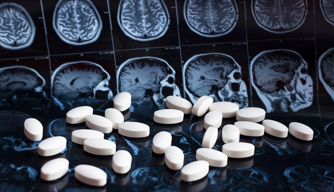 Current Alzheimer's Treatments: Managing Symptoms & Potential New Drugs