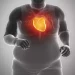 Health Risks of Obesity: Beyond Weight (Diabetes, Heart Disease, Cancer)