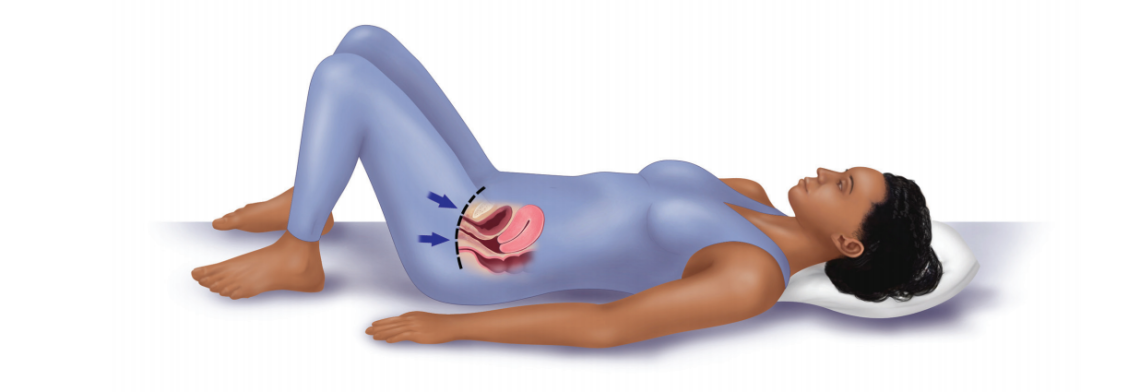 Bladder Training Techniques for Urge Incontinence