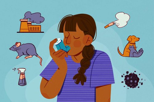 Understanding Asthma Triggers: Allergens, Irritants, Exercise, Weather