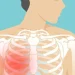 Costochondritis: Inflammation of Chest Wall Cartilage