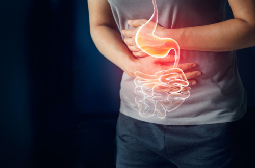 Chronic Abdominal Pain: IBS, IBD, GERD, and Functional Disorders