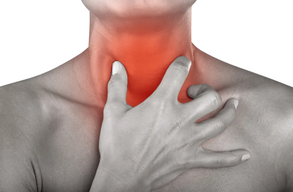 GERD/Acid Reflux and Throat Irritation (LPR)