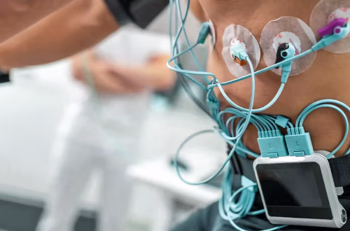 Diagnostic Tests for Chest Pain: EKG, Troponin, Stress Test, Angio