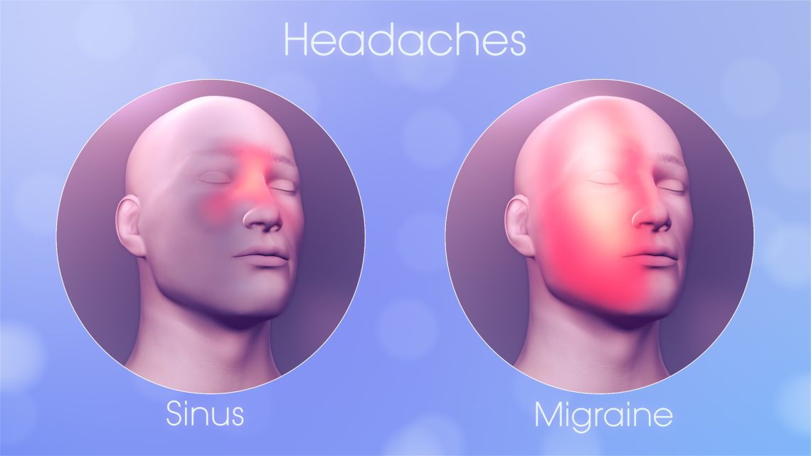 Sinus Headache vs. Migraine: How to Tell the Difference