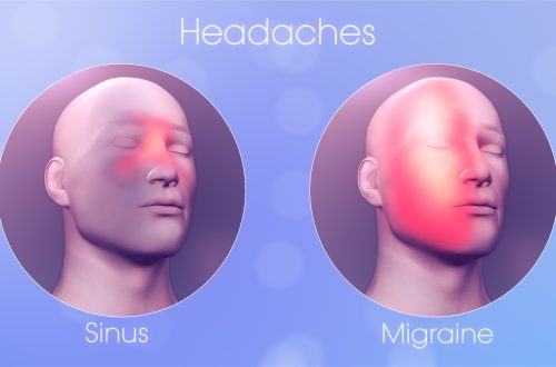 Sinus Headache vs. Migraine: How to Tell the Difference