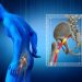 Sciatica Pain Relief: Managing Nerve Compression Symptoms