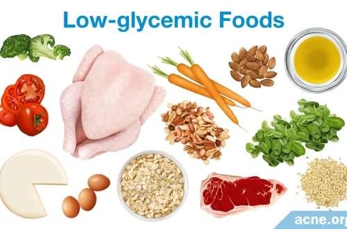 Diet and Acne: The Evidence on Sugar, Dairy, and High-Glycemic Foods