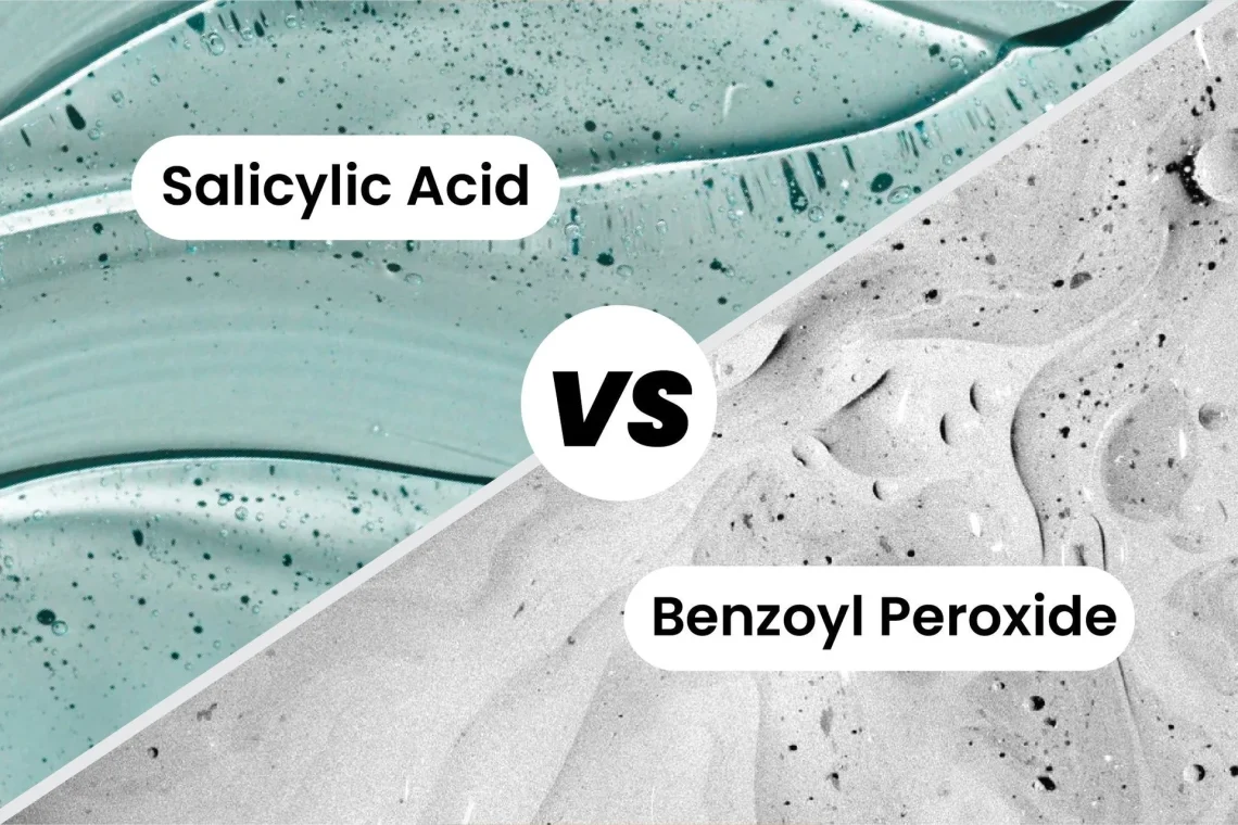 Spot Treatment Showdown: Ingredients That Work (Benzoyl Peroxide, Salicylic Acid)