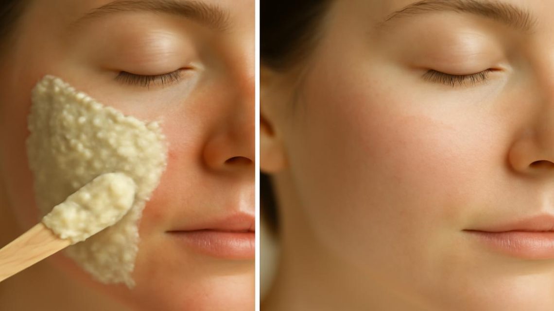 DIY Masks and Remedies for Pimple Reduction (Honey, Tea Tree Oil - Use Caution)