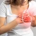 Heart Attack Symptoms in Women: Often Atypical (Shortness of Breath, Fatigue, Nausea)