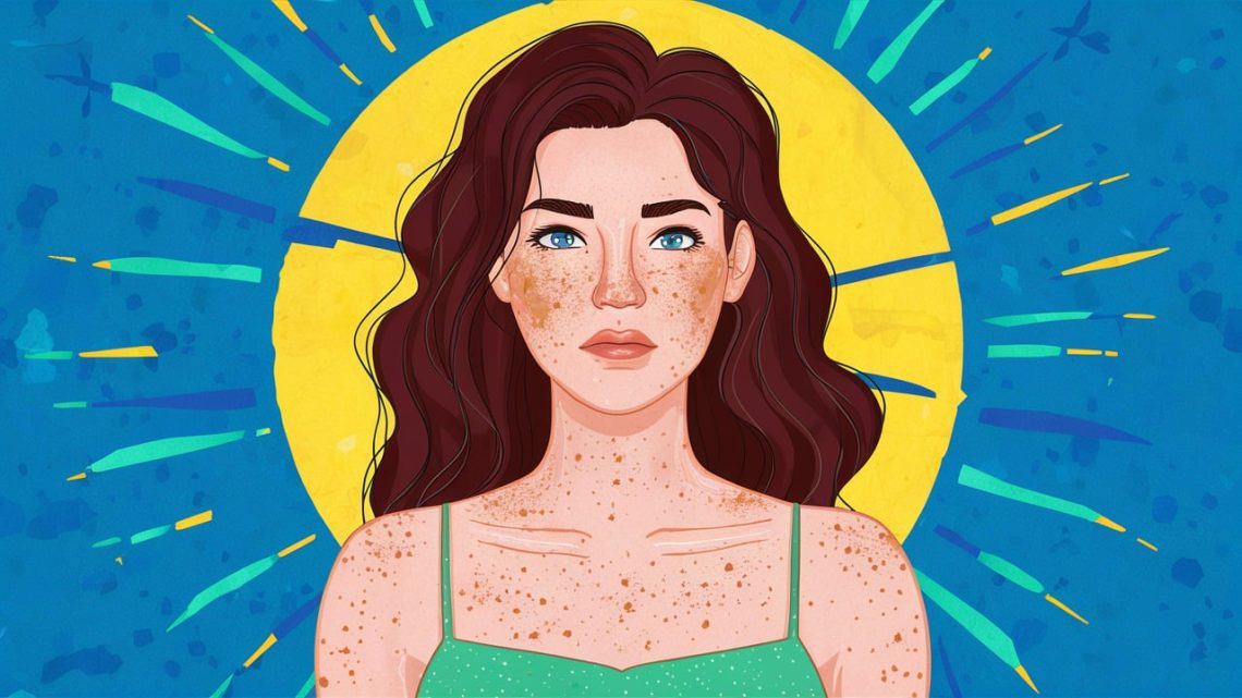 Sun Allergy Rash (Polymorphic Light Eruption)