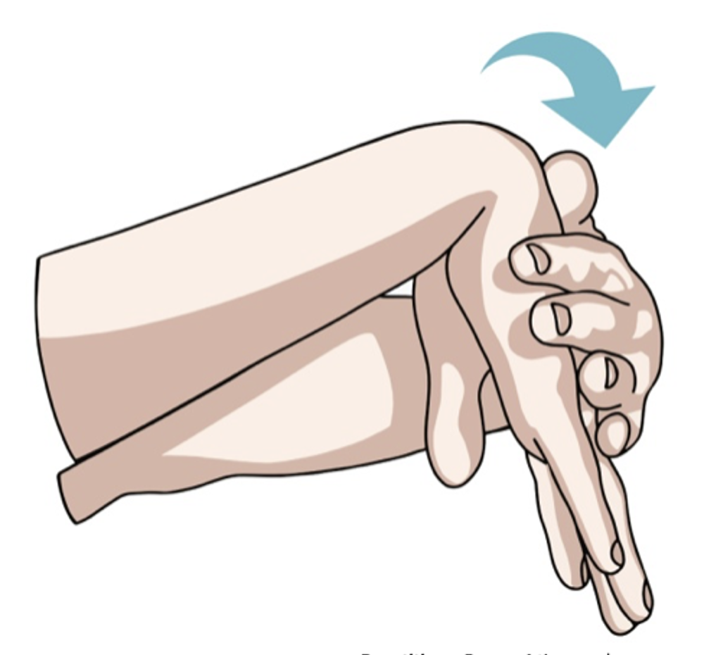 Less Common Pregnancy Symptoms (Nosebleeds, Skin Changes, Carpal Tunnel)