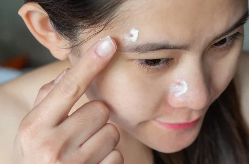 Salicylic Acid: Uses, Benefits, Side Effects, and Dosage Guidelines